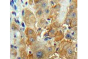 IHC-P analysis of Liver tissue, with DAB staining. (F12 antibody  (AA 352-587))