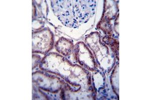 FER Antibody immunohistochemistry analysis in formalin fixed and paraffin embedded human kidney tissue followed by peroxidase conjugation of the secondary antibody and DAB staining.