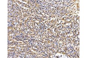 IHC analysis of Epac1/RAPGEF3 using anti-Epac1/RAPGEF3 antibody (ABIN7601858). (RAPGEF3 antibody  (AA 49-881))