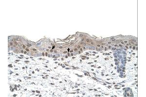 IHC Information: Human skin. (Arrestin 3 antibody  (Middle Region))