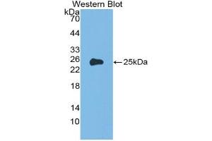 Detection of Recombinant a1AGP, Rat using Polyclonal Antibody to Alpha-1-Acid Glycoprotein (a1AGP) (ORM1 antibody  (AA 19-201))