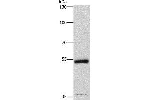 Western blot analysis of Human colon cancer tissue, using CYP2B6 Polyclonal Antibody at dilution of 1:400 (CYP2B6 antibody)