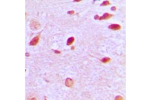 Immunohistochemical analysis of RAP1GAP staining in human brain formalin fixed paraffin embedded tissue section. (RAP1GAP antibody  (C-Term))