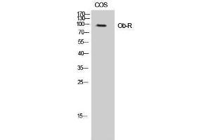 Western Blotting (WB) image for anti-Leptin Receptor (LEPR) (Ser75) antibody (ABIN3185988) (Leptin Receptor antibody  (Ser75))