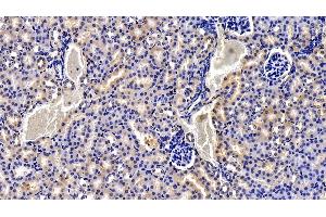 Immunohistochemistry (IHC) image for anti-Notch 2 N-terminal Like (NOTCH2NL) (AA 1-236) antibody (ABIN7430273)