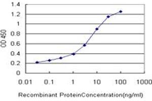 Detection limit for recombinant GST tagged ERN1 is approximately 0. (ERN1 antibody  (AA 401-500))