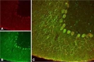 Expression of KCNK4 in rat cerebellum - Immunohistochemical staining of rat cerebellum using Anti-KCNK4 (TRAAK) Antibody (ABIN7043454, ABIN7045004 and ABIN7045005) ). (KCNK4 antibody  (C-Term, Intracellular))