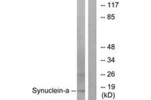 Western blot analysis of extracts from 293 cells, treated with Etoposide 25myM 60', using Synuclein-alpha (Ab-133) Antibody. (SNCA antibody  (AA 91-140))