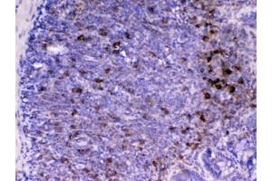 IHC testing of FFPE rat lymph tissue with CD14 antibody at 1ug/ml. (CD14 antibody  (AA 16-260))