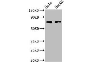 Western Blot Positive WB detected in: Hela whole cell lysate, HepG2 whole cell lysate All lanes: FRMD6 antibody at 3 μg/mL Secondary Goat polyclonal to rabbit IgG at 1/50000 dilution Predicted band size: 73, 71, 30 kDa Observed band size: 73 kDa