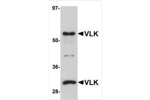 Western blot analysis of VLK in human lung tissue lysate with VLK antibody at 1 μg/ml. (PKDCC antibody  (Center))