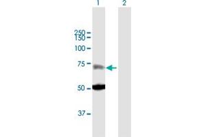 Western Blot analysis of ZNF182 expression in transfected 293T cell line by ZNF182 MaxPab polyclonal antibody. (ZNF182 antibody  (AA 1-620))