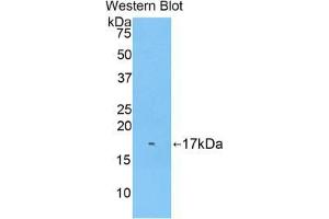 Western blot analysis of the recombinant protein. (Biglycan antibody  (AA 243-369))