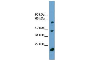 WB Suggested Anti-TBL1Y Antibody Titration:  0. (TBL1Y antibody  (Middle Region))