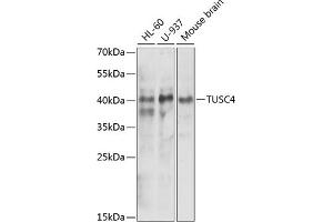 Western blot analysis of extracts of various cell lines, using NPRL2 antibody (ABIN6132809, ABIN6144787, ABIN6144788 and ABIN6221564) at 1:1000 dilution.