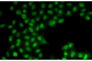 Immunofluorescence analysis of U2OS cells using C11orf30 Polyclonal Antibody (EMSY antibody)