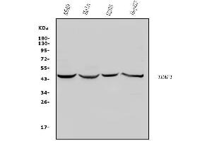 Western blot analysis of TRAF1 using anti-TRAF1 antibody (ABIN7600020).