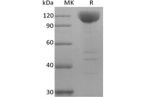 Western Blotting (WB) image for Sialic Acid Binding Ig-Like Lectin 10 (SIGLEC10) (Active) protein (Biotin) (ABIN7319878) (SIGLEC10 Protein (Biotin))