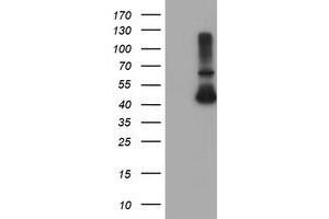 HEK293T cells were transfected with the pCMV6-ENTRY control (Left lane) or pCMV6-ENTRY ADH7 (Right lane) cDNA for 48 hrs and lysed. (ADH7 antibody)