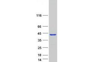 Validation with Western Blot (STARD10 Protein (Myc-DYKDDDDK Tag))