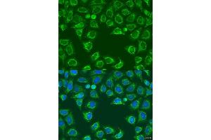 Immunofluorescence analysis of U2OS cells using  antibody (ABIN7265695) at dilution of 1:100. (ALG2 antibody  (AA 197-416))