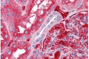 Human Kidney: Formalin-Fixed, Paraffin-Embedded (FFPE) (APOA2 antibody  (AA 1-100))
