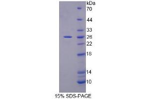 SDS-PAGE analysis of Mouse PLCL1 Protein.