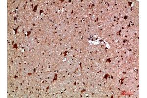 Immunohistochemical analysis of paraffin-embedded human-brain, antibody was diluted at 1:200
