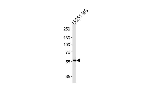 PHF17 antibody  (N-Term)