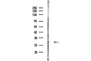 anti-Low Density Lipoprotein Receptor Class A Domain Containing 2 (LDLRAD2) (Internal Region) antibody
