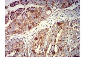 Immunohistochemistry (IHC) image for anti-CD63 (CD63) (AA 103-203) antibody (ABIN5684142)