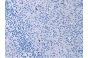 IHC-P analysis of Mouse Ovary Tissue, with DAB staining. (ATF6 antibody  (AA 1-377))