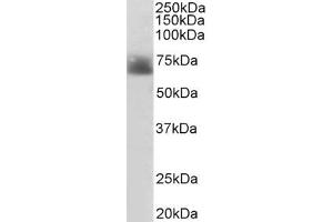 ABIN185394 (2µg/ml) staining of Human Colon lysate (35µg protein in RIPA buffer). (SLC6A4 antibody  (Internal Region))