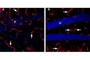 Expression of Aquaporin 4 in rat and mouse brain - Immunohistochemical staining of Aquaporin 4 in rat and mouse brain free floating frozen sections using Anti-Aquaporin 4 (AQP4) (300-314)-ATTO Fluor-594 Antibody (ABIN7042940), (1:80). (Aquaporin 4 antibody  (Intracellular) (Atto 594))