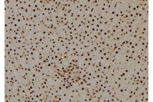 ABIN6269146 at 1/100 staining Rat liver tissue by IHC-P. (Cyclin B1 antibody  (Internal Region))