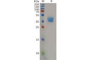Human CCR4 Protein, hFc Tag on SDS-PAGE under reducing condition. (CCR4 Protein (Fc Tag))