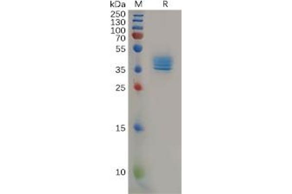CCR4 Protein (Fc Tag)