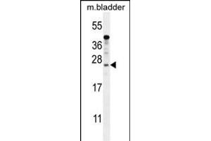 KI Antibody (N-term) (ABIN654385 and ABIN2844131) western blot analysis in mouse bladder tissue lysates (35 μg/lane). (SHISAL1/KIAA1644 antibody  (N-Term))