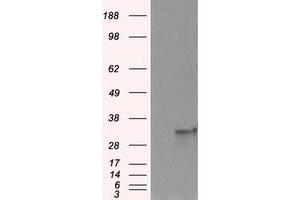 Image no. 5 for anti-Fumarylacetoacetate Hydrolase Domain Containing 2A (FAHD2A) antibody (ABIN1498182) (FAHD2A antibody)