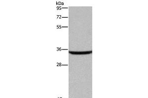 Western Blot analysis of Human fetal brain tissue using DKK3 Polyclonal Antibody at dilution of 1:200 (DKK3 antibody)