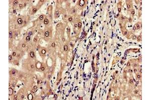 Immunohistochemistry (IHC) image for anti-Endoplasmic Reticulum Aminopeptidase 1 (ERAP1) (AA 642-941) antibody (ABIN7151655)