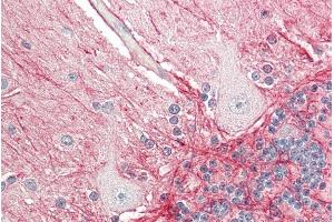 ABIN870659 (5µg/ml) staining of paraffin embedded Human Cerebellum. (APP antibody  (N-Term))
