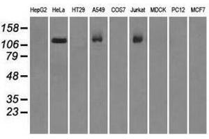 Image no. 2 for anti-Budding Uninhibited By Benzimidazoles 1 Homolog beta (Yeast) (BUB1B) antibody (ABIN1496996) (BUB1B antibody)