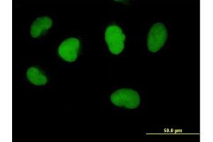 Immunofluorescence of purified MaxPab antibody to FBXO11 on HeLa cell. (FBXO11 antibody  (AA 1-843))