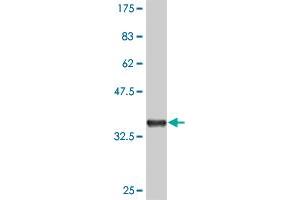 Western Blot detection against Immunogen (36. (MAPKAP Kinase 3 antibody  (AA 59-153))