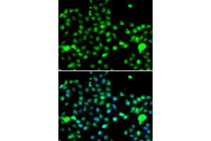 Immunofluorescence analysis of A549 cells using IP6K2 antibody. (IP6K2 antibody)