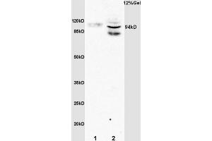L1 rat brain lysates L2 rat liver lysates probed with Anti Phospho-STAT6(Tyr641) Polyclonal Antibody, Unconjugated (1791R) at 1:200 overnight at 4 °C.