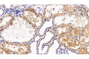 Immunohistochemistry (IHC) image for anti-Chemokine (C-X-C Motif) Receptor 4 (CXCR4) (AA 262-352) antibody (ABIN7432925)