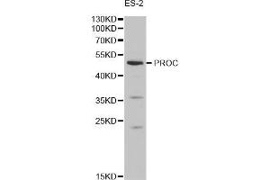 Western blot analysis of extracts of ES-2 cells, using PROC antibody (ABIN5970669) at 1/1000 dilution. (PROC antibody)