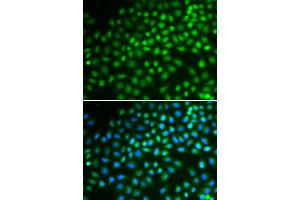 Immunofluorescence analysis of HeLa cells using SMARCA5 antibody. (SMARCA5 antibody)